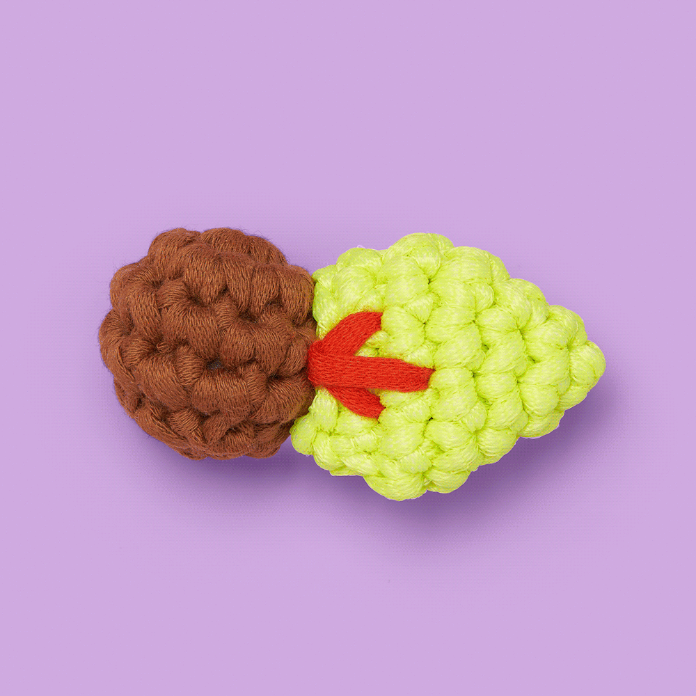 Alternative view of Tiny Comet Accessory Kit